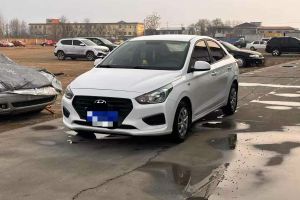 瑞納 現(xiàn)代 
